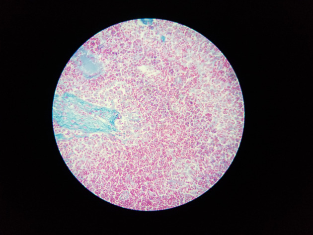 Reticular Connective Slides - Reticular Connective 03 100X